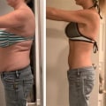 The Med Spa Edge: Why Frankfort Health Consultants Recommend Semaglutide For Sustainable Weight Loss