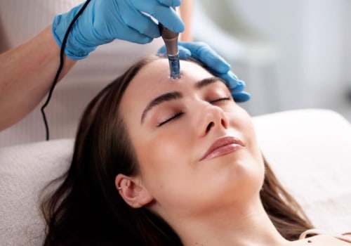 Microneedling 101: Why Consulting A Health Professional In Phoenix Is Essential For Skin Health
